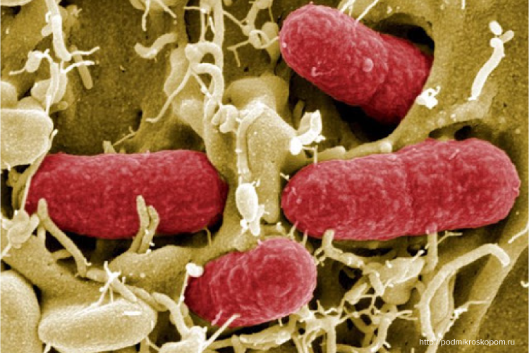 бактерии кишечной палочки